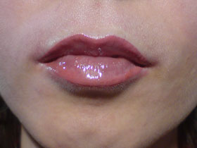 natural lips